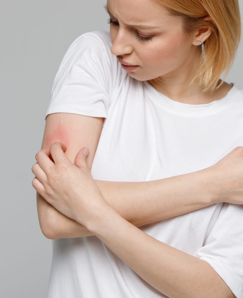 Woman scratching her arm