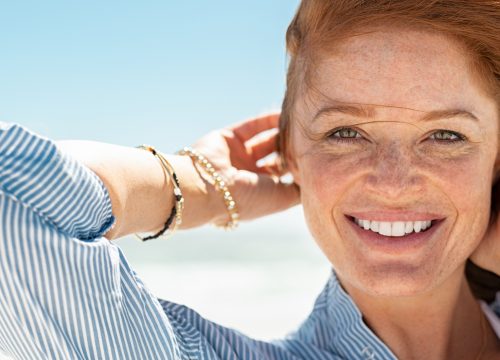 Red-headed woman with sun damage