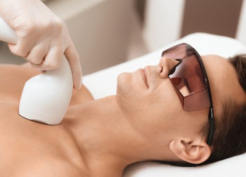 Man getting a treatment to remove unwanted body hair