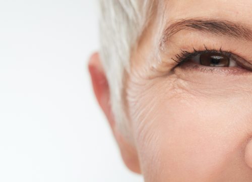Close-up on the wrinkles and fine lines around a woman's eye