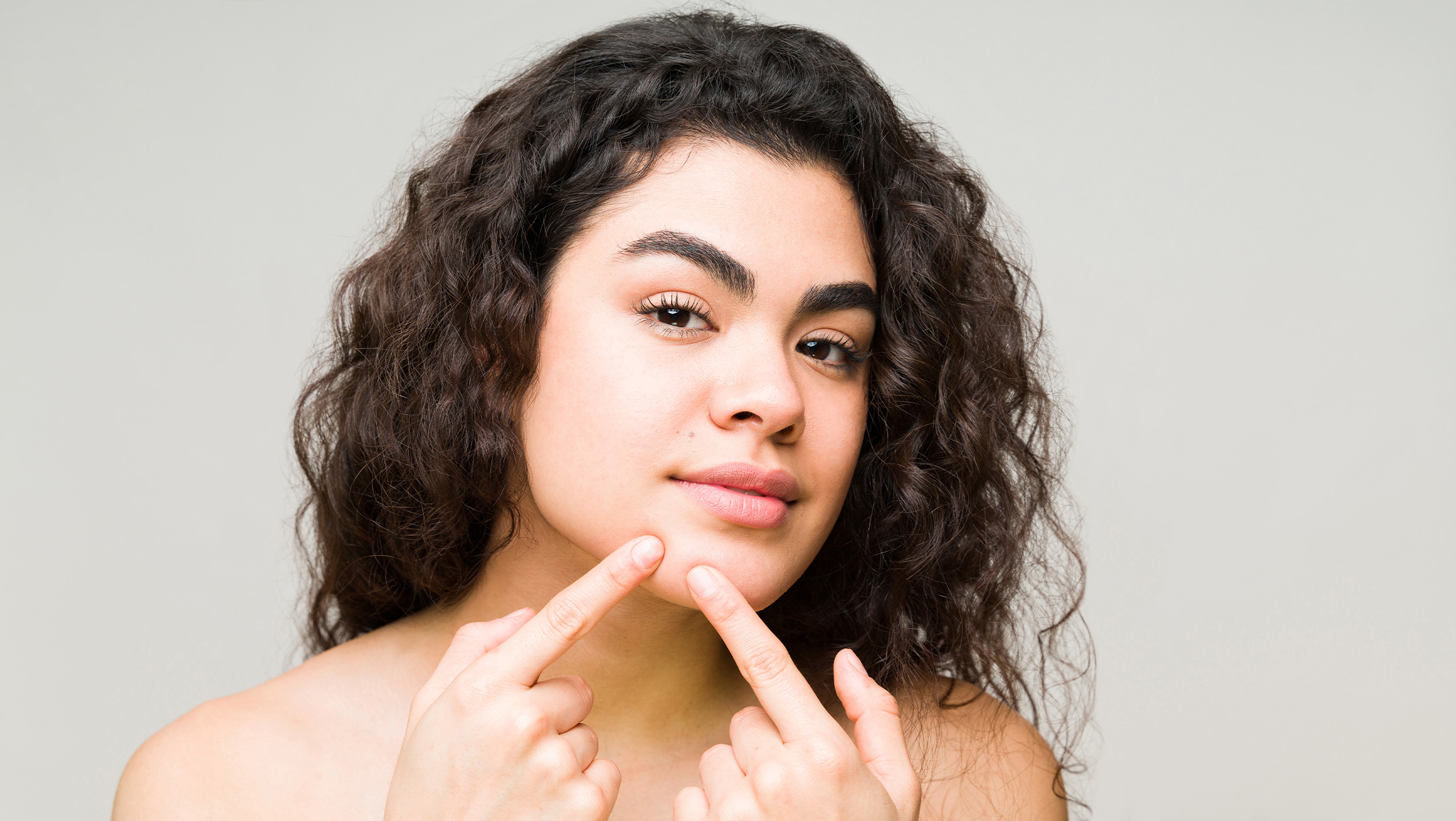 AviClear™ Acne Reduction in Sarasota, FL
